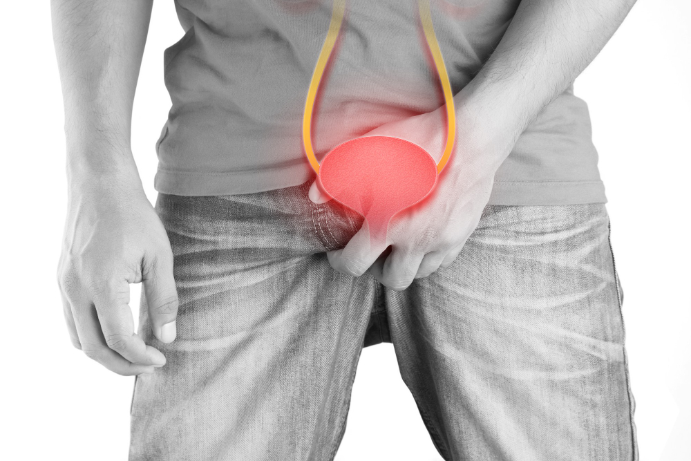 Diagnóstico y tratamiento del cáncer de vejiga